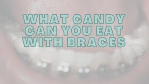 What Candy Can You Eat With Braces?
